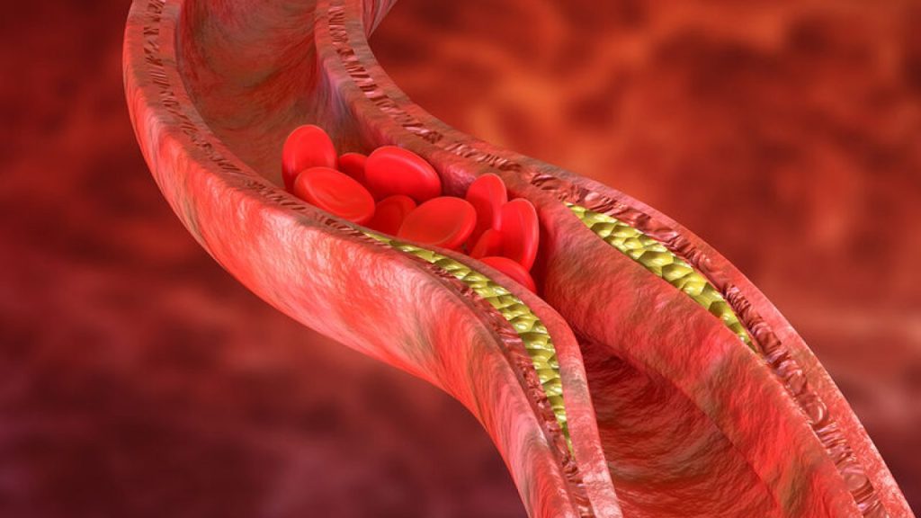 Αυτή είναι η διατροφή που «καθαρίζει» τις αρτηρίες