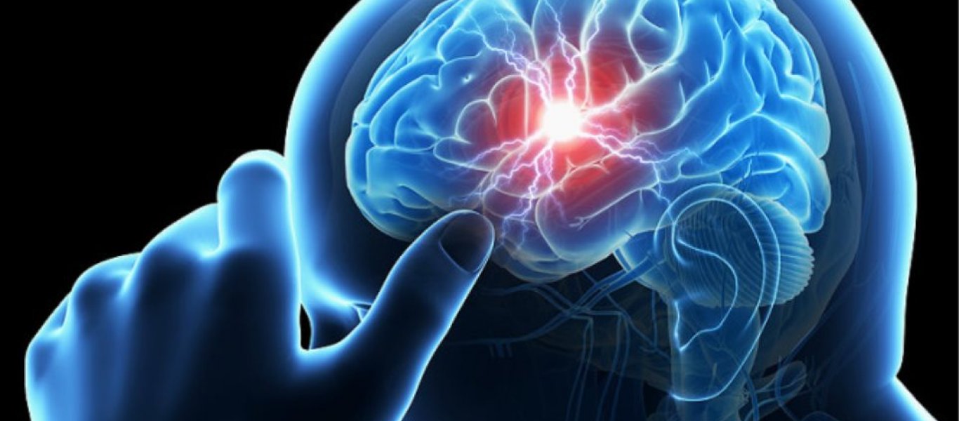 Εγκεφαλικό επεισόδιο: Πως ο εγκέφαλος «πνίγεται» στα υγρά του μετά το περιστατικό (βίντεο)
