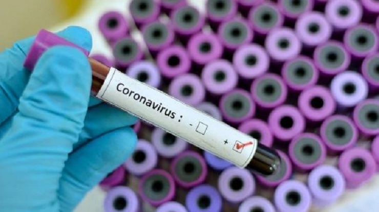 NYT: «Πωλούν αίμα θεραπευμένων από Covid-19 για 40.000 δολάρια το 1 ml»!