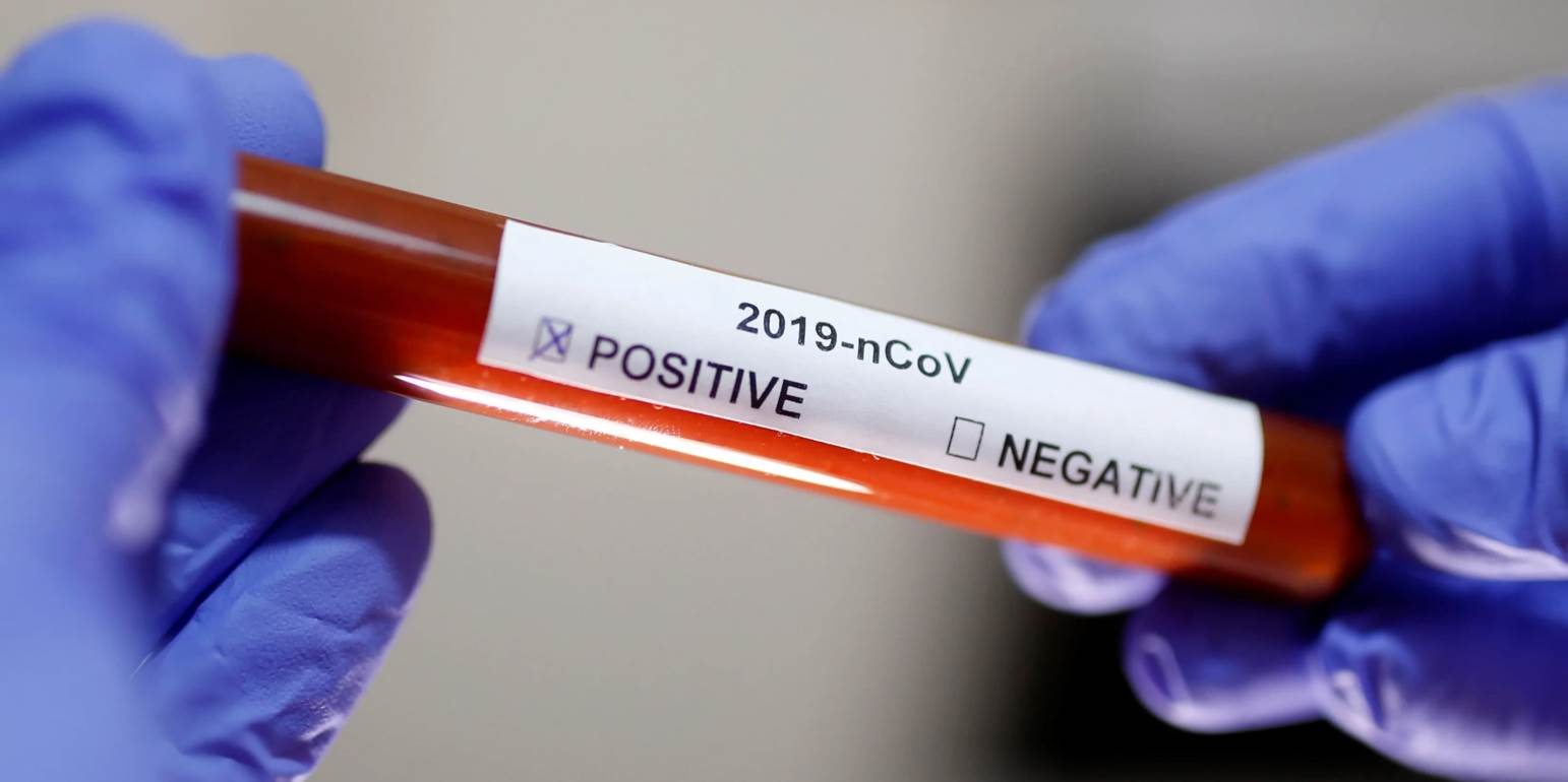 Ραγδαία αύξηση των διαγνωστικών τεστ για τον κορωνοϊό στην Ελλάδα – Δείτε πόσα έγιναν τις τελευταίες μέρες