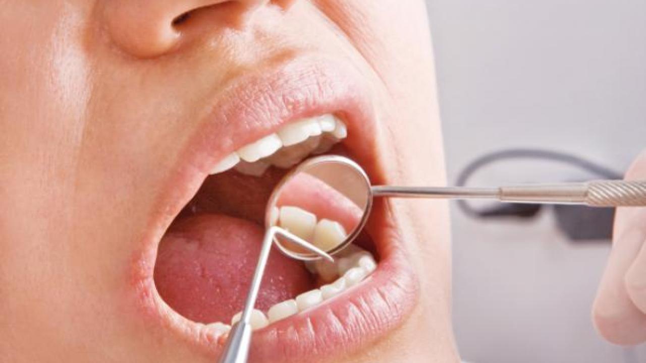 Δείτε τι πρέπει να κάνετε για να προλάβετε την ουλίτιδα