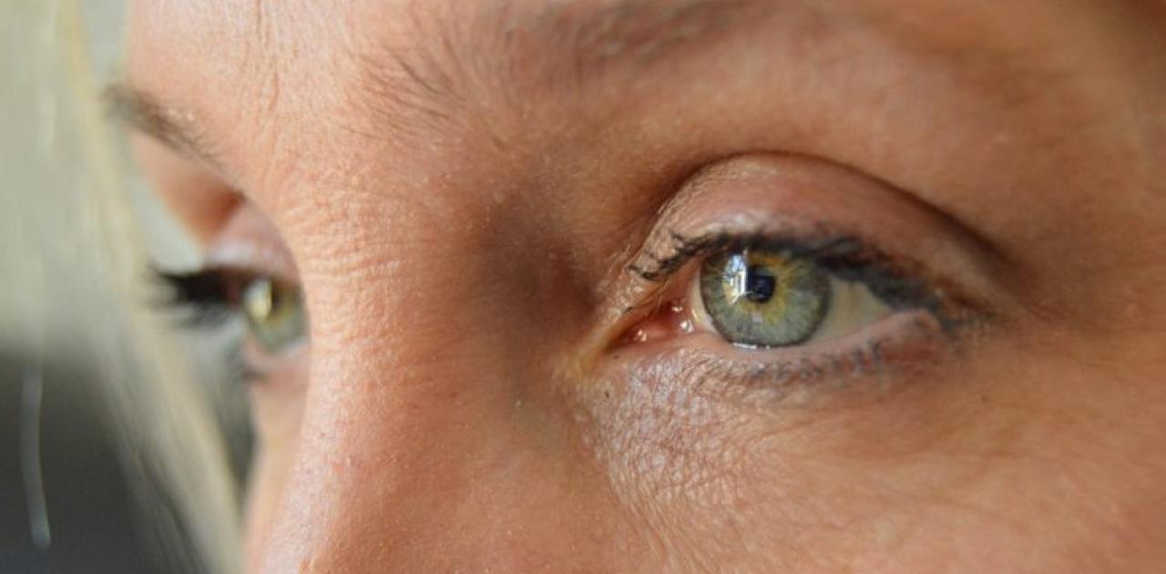 Έρπης στα μάτια: Συμπτώματα και πως να τον αντιμετωπίσετε