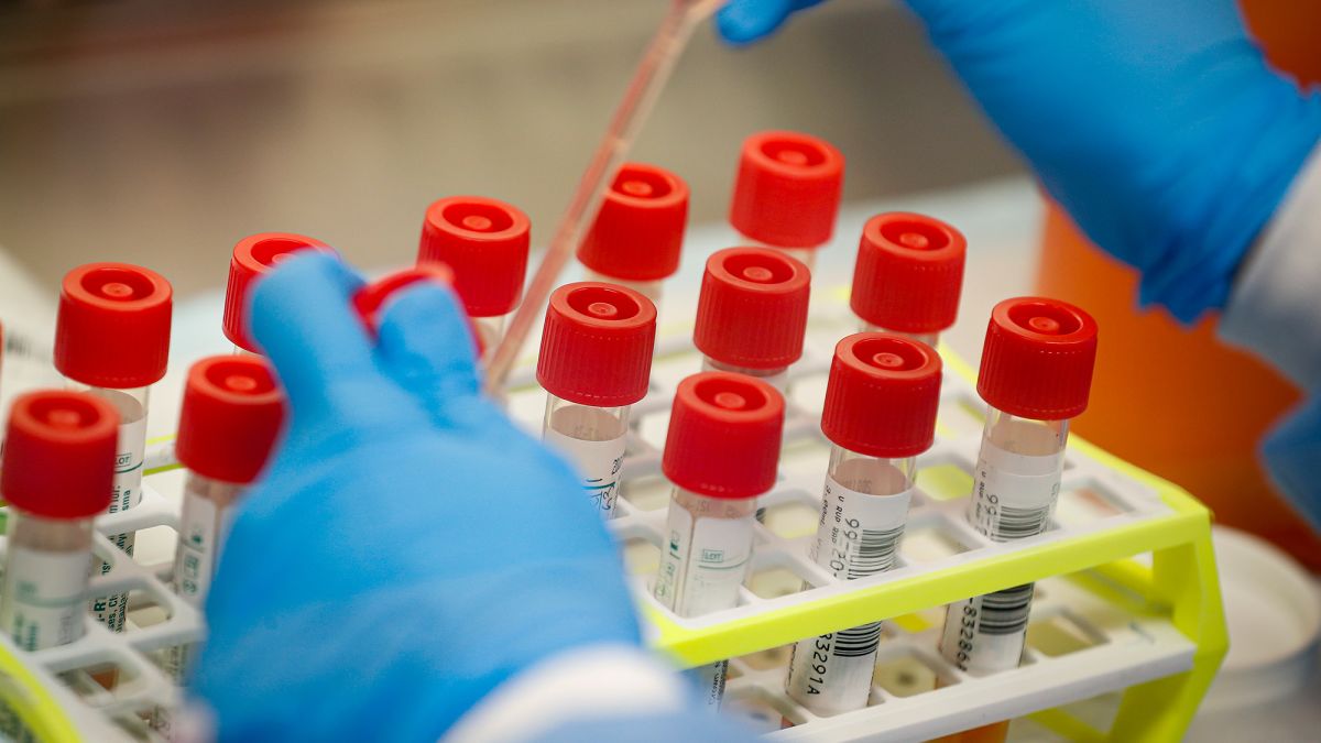 Φθιώτιδα: Τι έδειξαν τα αποτελέσματα των τεστ για τον κορωνοϊό;