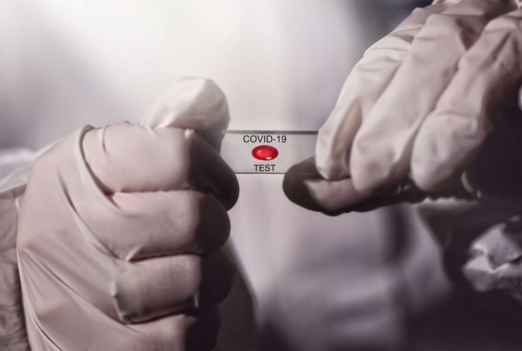 Παραιτήθηκε ο υπουργός Υγείας της Χιλής ενώ η πανδημία του κορωνοϊού μαίνεται