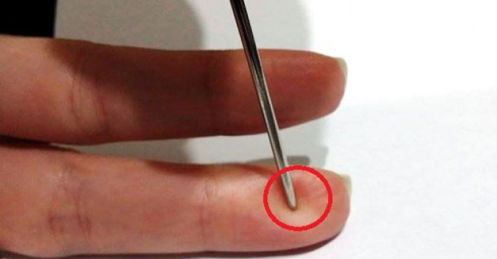 Αυτός είναι ο λόγος που πρέπει να έχετε πάντα μια βελόνα στην τσέπη σας – Και είναι σοβαρός!