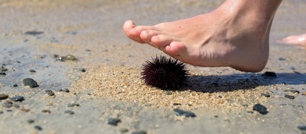 Πατήσατε αχινό; – Δείτε βήμα-βήμα τι πρέπει να κάνετε