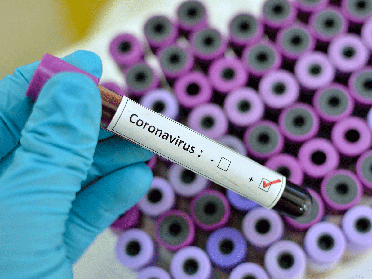 Ρωσία: Εγκρίθηκε ένα ακόμα φάρμακο κατά του κορωνοϊού – 15 Ιουλίου δοκιμές για εμβόλιο
