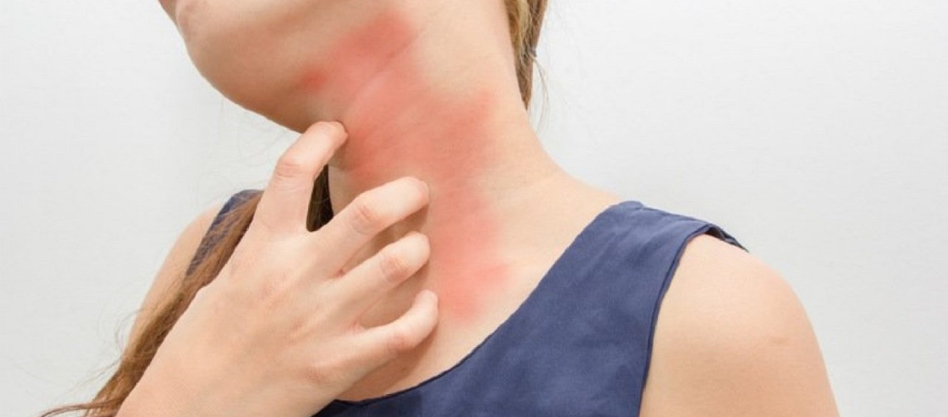 Με αυτό το φρούτο θα πείτε «τέλος» στις δερματικές αλλεργίες