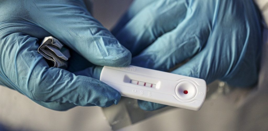 Συναγερμός σε κατασκήνωση στη Χαλκιδική – Θετικό στον κορωνοϊό ένα κορίτσι