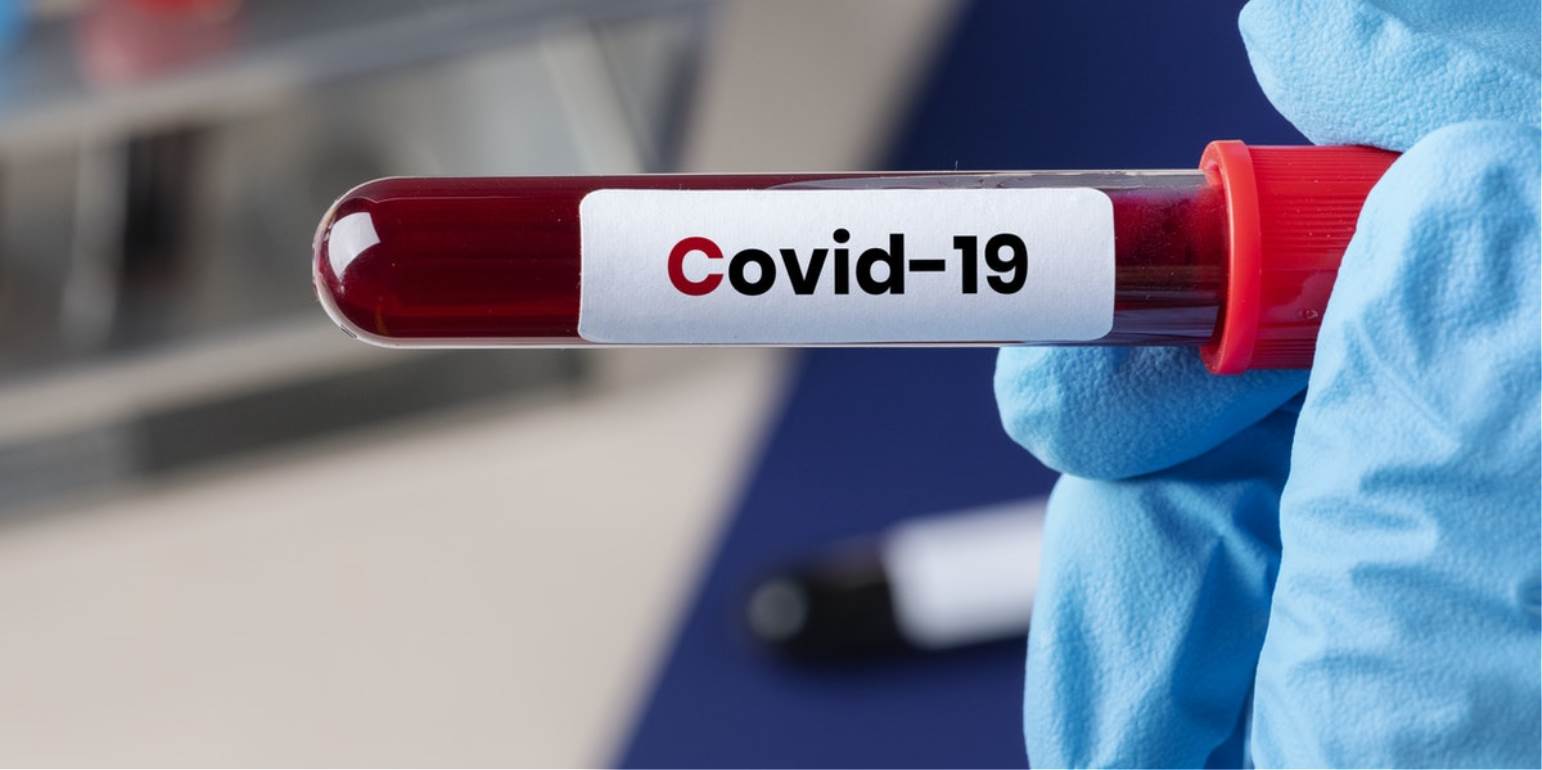 Κορωνοϊός: Ξεκίνησε η πρώτη οροεπιδημιολογική μελέτη του ΕΚΠΑ για τον ιό – Επιλέχθηκαν 5.000 δότες