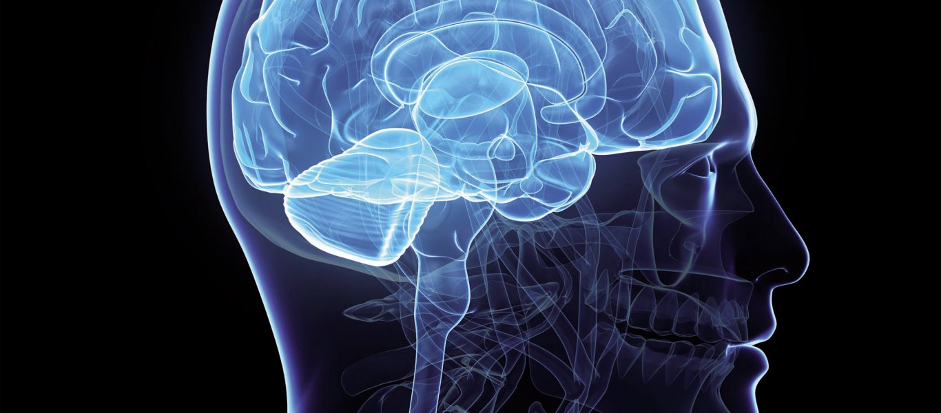 Ανεύρυσμα εγκεφάλου: Το νου σας σε αυτά τα «αθώα» συμπτώματα