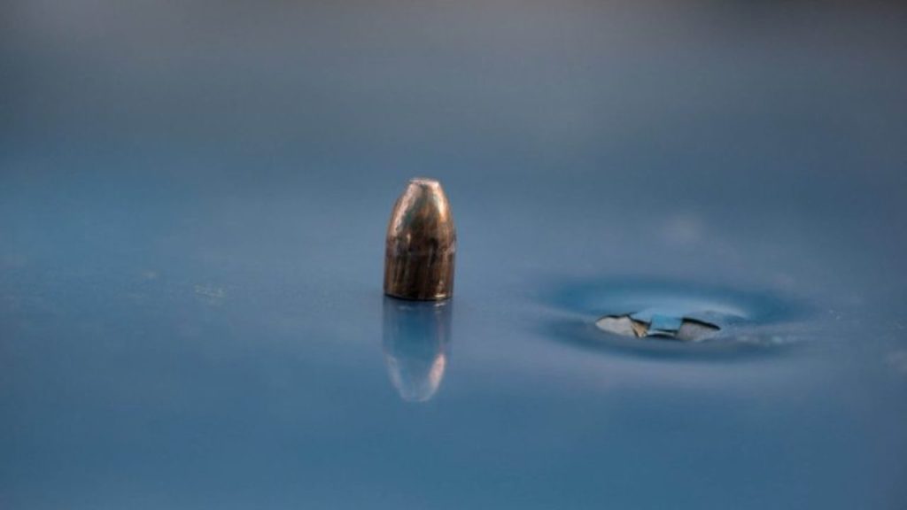 Ισραήλ: 9χρονος είχε σφαίρα καρφωμένη στον εγκέφαλο του (φώτο)