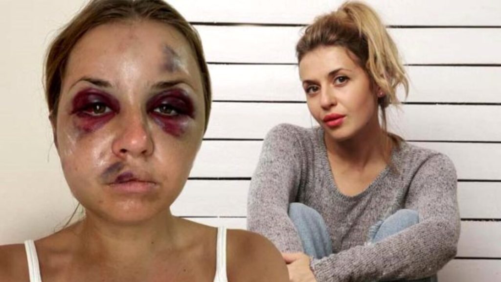 Τρόμος για Ουκρανή παρουσιάστρια: 45χρονος την ξυλοκόπησε και προσπάθησε να τη βιάσει μπροστά στον γιο της (φώτο)