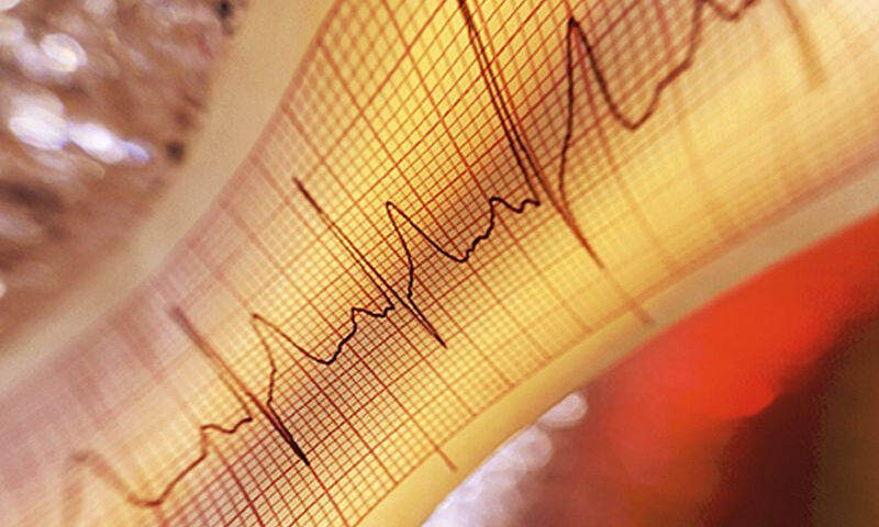 Κολπική μαρμαρυγή: Με ποιους τύπους καρκίνου συνδέεται