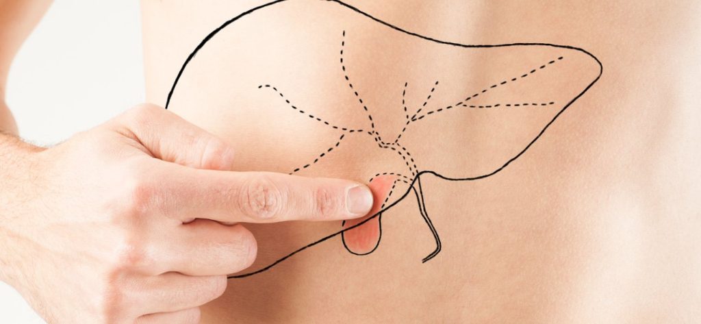 Αυτές οι τροφές βοηθούν στην φυσική διάσπαση της πέτρας στην χολή