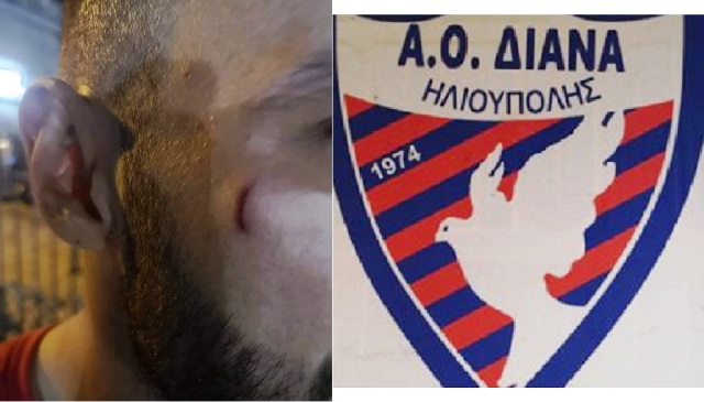 Ηλιούπολη: Φωτογραφίες από τον μαχαιρωμένο τερματοφύλακα της ΔΙΑΝΑ (φώτο)