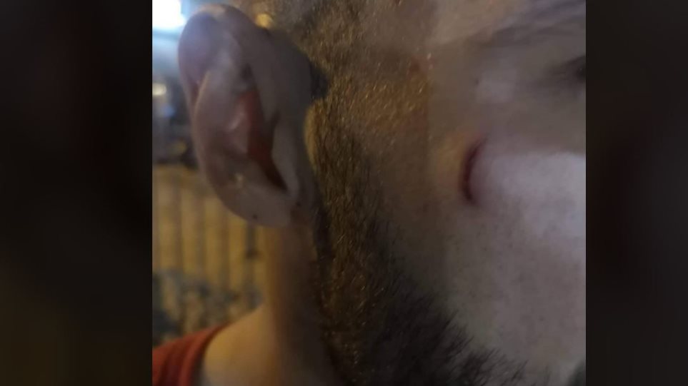 Ηλιούπολη: Χαράκωσαν τερματοφύλακα ερασιτεχνικής ομάδας σε φιλικό