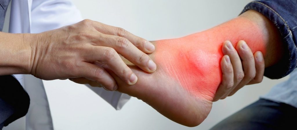 Ουρικό οξύ: Ποια είναι η κατάλληλη διατροφή; – Αναλυτικά τι περιλαμβάνει