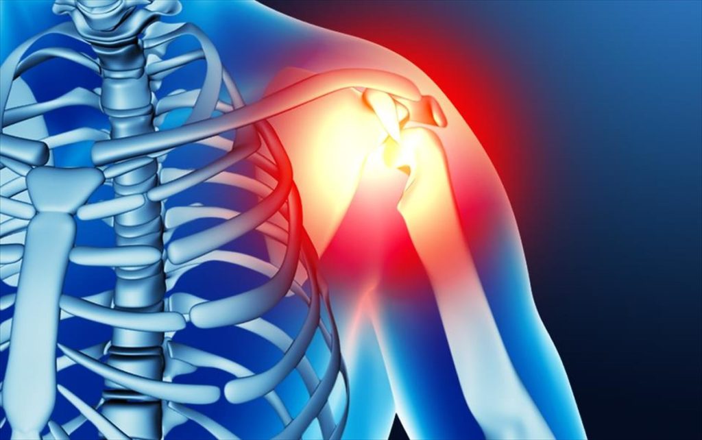 Οστεοπενία: Aυτές είναι οι τροφές που θα σας βοηθήσουν να την αντιμετωπίσετε