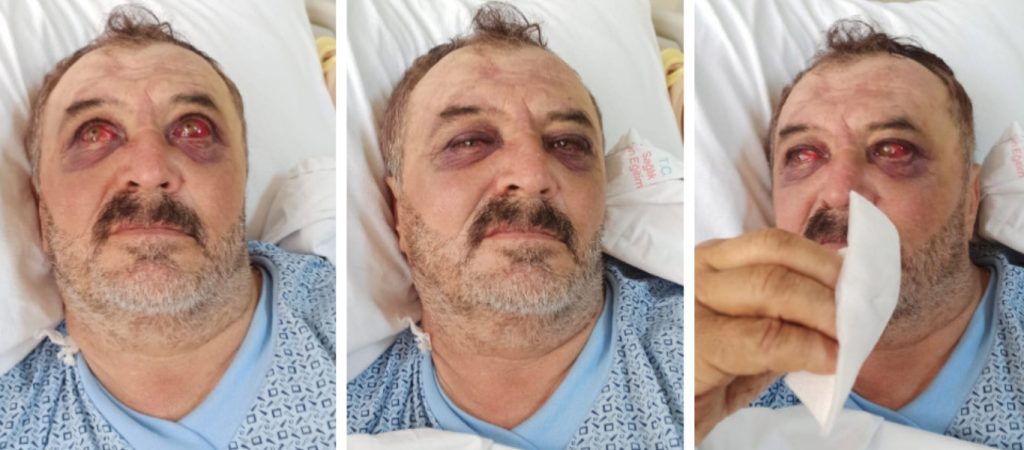 Αποτρόπαια βασανιστήρια σε Κούρδους που συνελήφθησαν στην Τουρκία