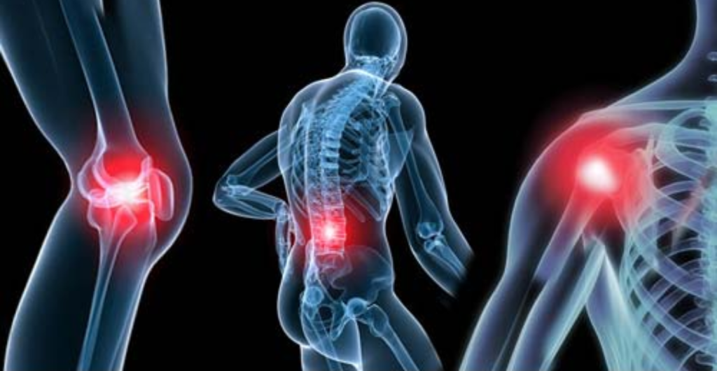 Οστεοπόρωση: Αυτές είναι οι τροφές που ενδυναμώνουν τα οστά