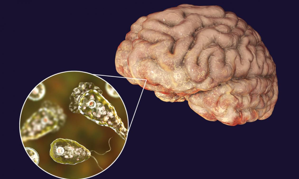 Τέξας: Εντοπίστηκε αμοιβάδα που τρέφεται με ανθρώπινο εγκέφαλο – Σε κατάσταση έκτακτης ανάγκης 8 περιοχές
