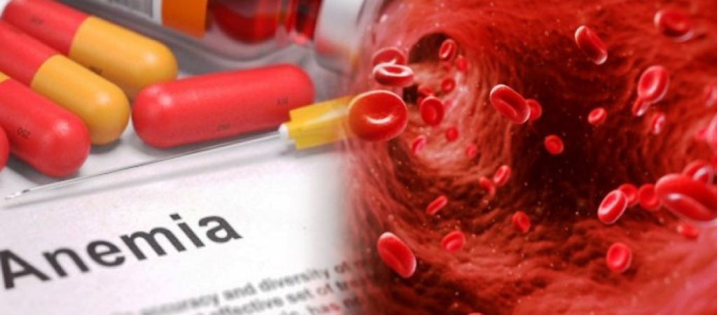 Αυτά είναι όλα τα συμπτώματα της αναιμίας – Πότε πρέπει να δείτε ένα γιατρό