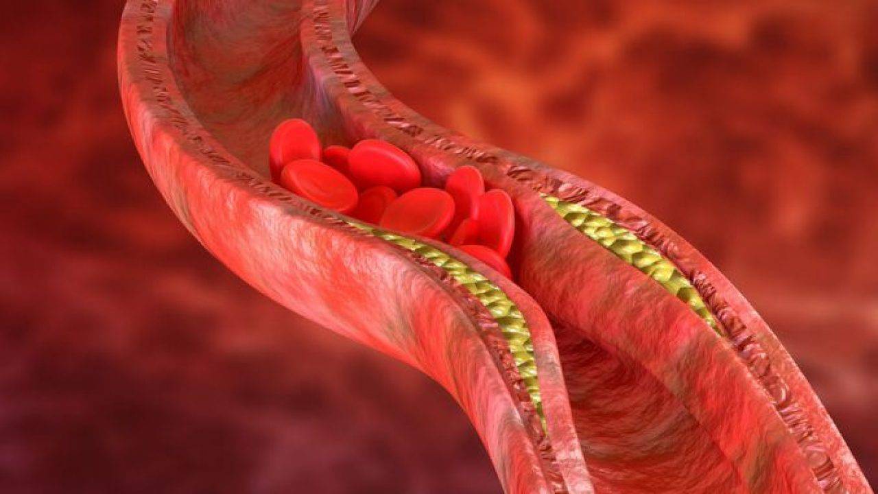 Με αυτές τις τροφές θα «καθαρίσετε» τις αρτηρίες σας