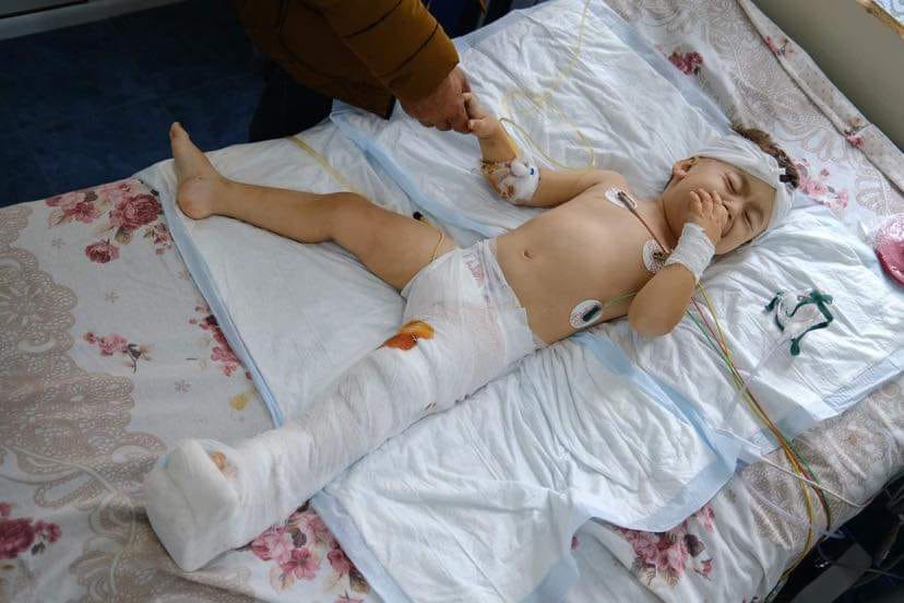 Συγκλονιστική εικόνα: Μωράκι δύο μηνών βαριά τραυματισμένο από τον βομβαρδισμό των Αζέρων (φώτο)