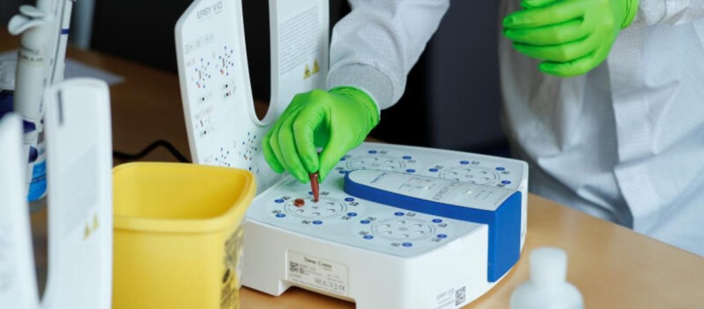 Γαλλία: Νέο τεστ κορωνοϊού χωρίς την χρήση μπατονέτας – Δίνει αποτέλεσμα σε 40 λεπτά