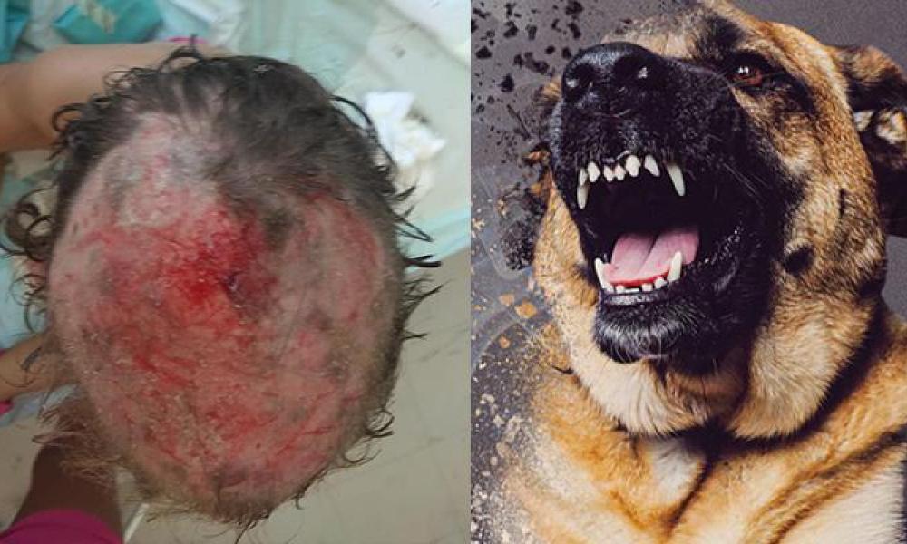 Κορινθία: Σκυλιά επιτέθηκαν σε κοριτσάκι και το τραυμάτισαν σοβαρά