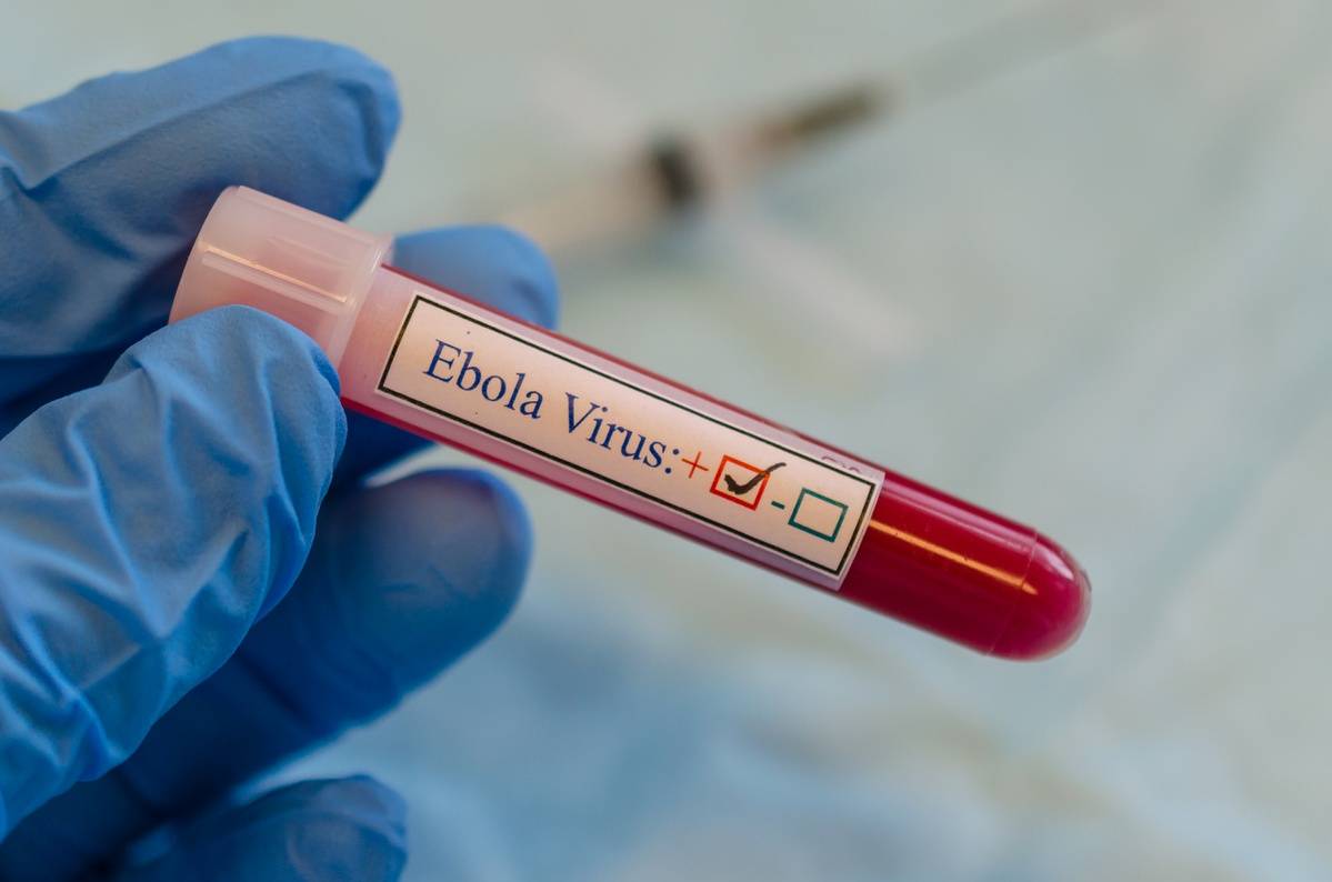 Ιός του Έμπολα: Εγκρίθηκε η πρώτη θεραπεία – Πως δρα το νέο φάρμακο