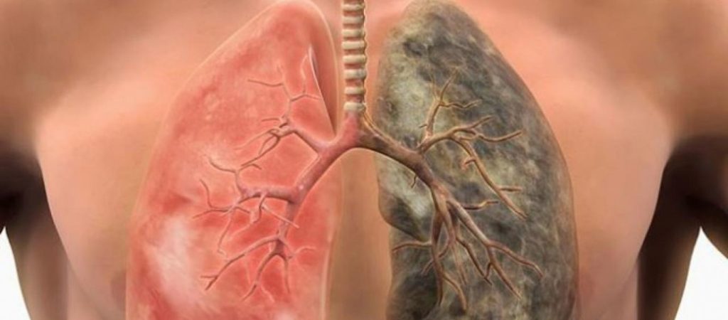 Αυτές οι έξι τροφές θα καθαρίσουν τη νικοτίνη από τον οργανισμό σας