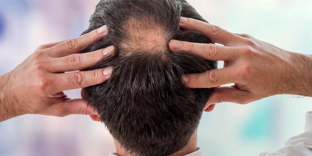 Θα σας «σώσει»: Aυτό το έλαιο προκαλεί αύξηση μαλλιών κατά 40%!