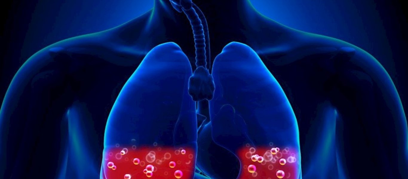 Πνευμονικό οίδημα: Τα πρώτα συμπτώματα – Τι πρέπει να κάνετε άμεσα