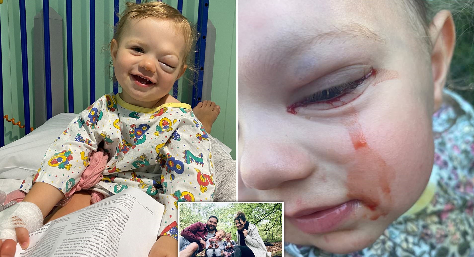 Αγγλία: Μπέμπα κλαίει δάκρυα από αίμα – Γεννήθηκε με όγκο στο μάτι (φωτό)