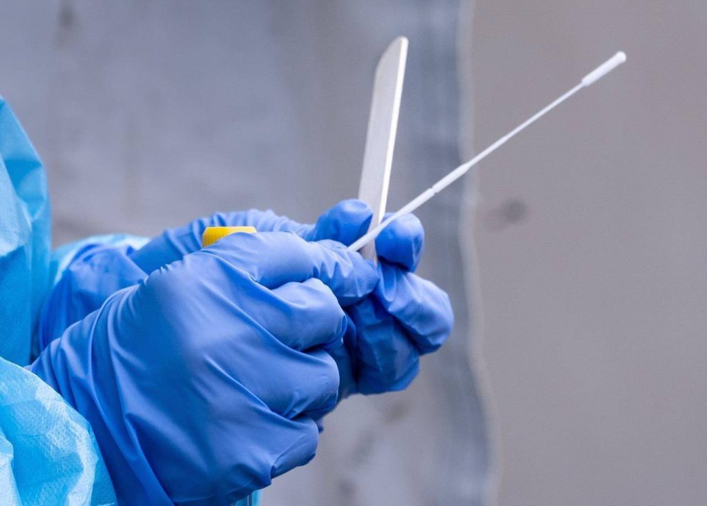 EE: Zητά να γίνονται συχνότερα rapid test