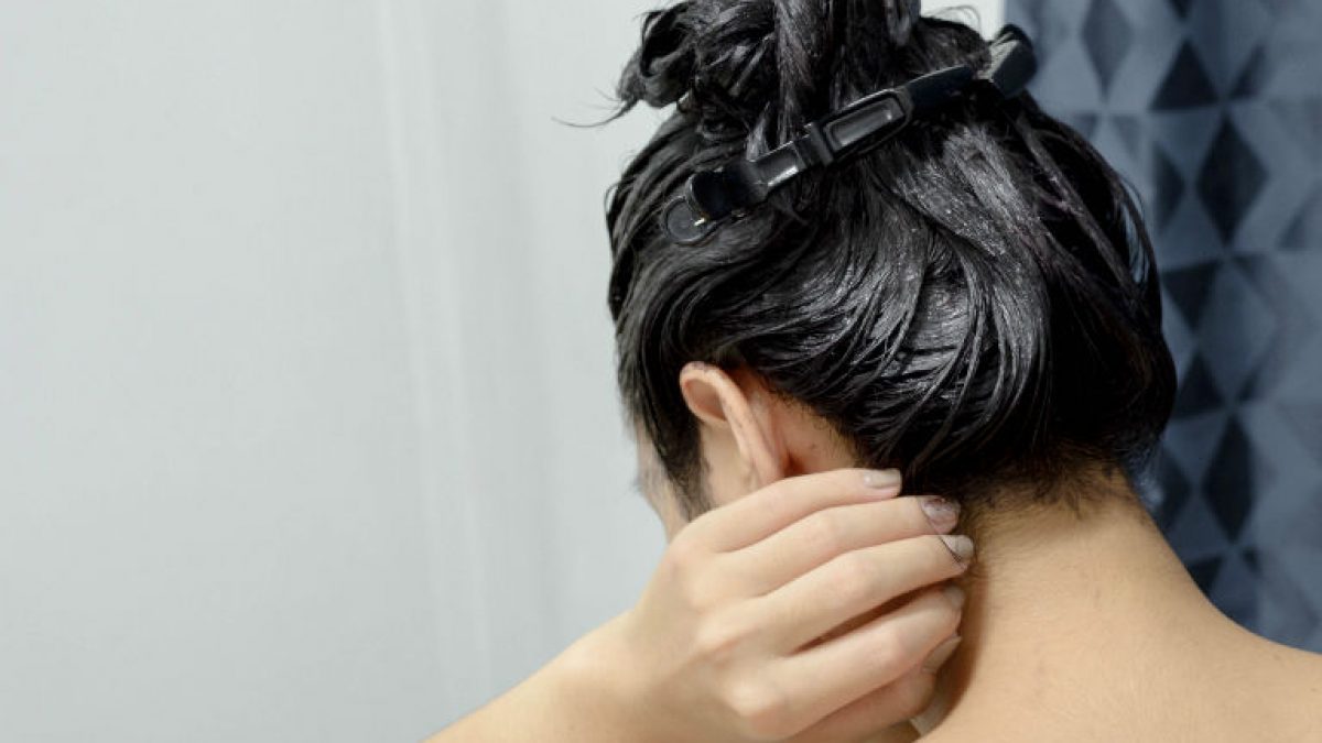 Νεαρή φοιτήτρια αποφάσισε να βάψει τα μαλλιά της και το κεφάλι της πρήστηκε σαν… μπάλα ποδοσφαίρου (βίντεο)