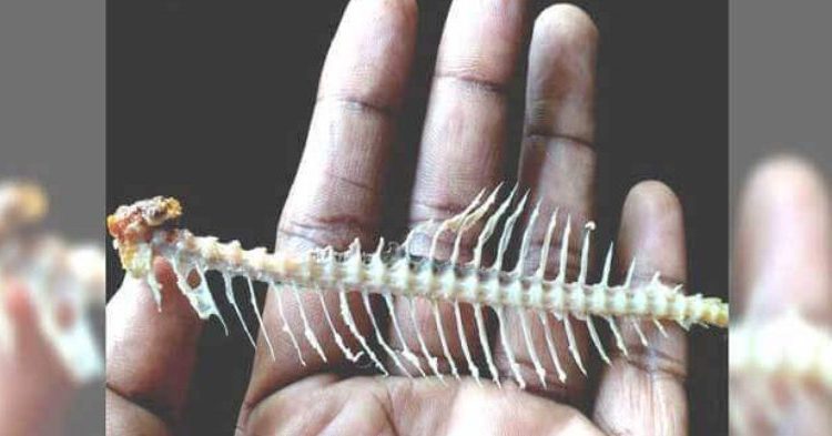 Προσοχή: Τι να κάνετε αν σας κάτσει κόκαλο από ψάρι στον λαιμό