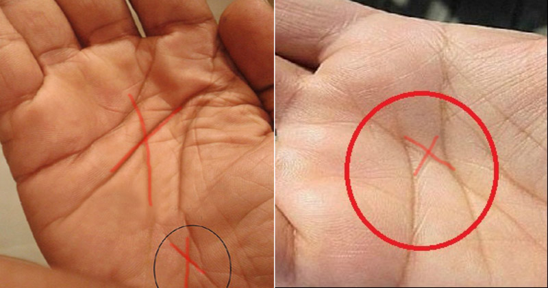 Μήπως έχετε το γράμμα «χ» στην παλάμη σας; – Όλα όσα πρέπει να γνωρίζετε (βίντεο)