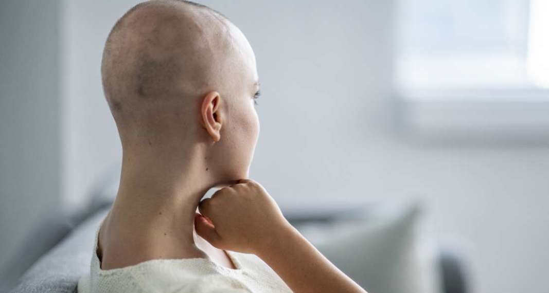 Γυναίκα έκανε πως έχει καρκίνο και ξύρισε το κεφάλι της για να… παντρευτεί με χλιδή (βίντεο)