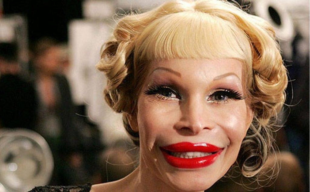 Νόμιζαν πως θα πετύχουν αλλά… – Οι 10 πιο αποτυχημένες πλαστικές επεμβάσεις που έχουν κάνει διάσημοι (φώτο)