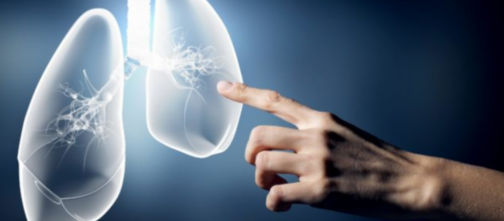 Οι ασθενείς με Κυστική Ίνωση απαλλάσσονται από το τέλος ταξινόμησης και τα τέλη κυκλοφορίας