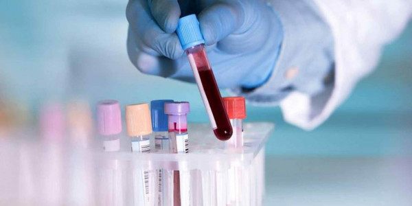 Mελλοντικό τεστ αίματος θα δείχνει κατά πόσο «δουλεύει» ένα εμβόλιο κατά της Covid-19.