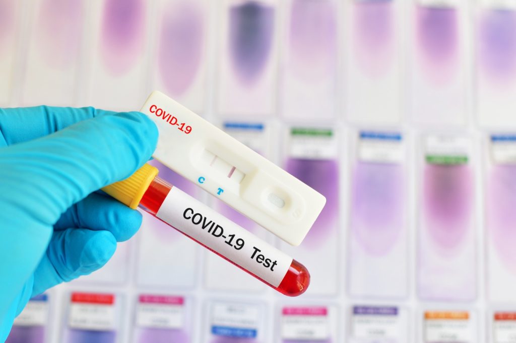 ΕΟΔΥ: Δείτε τα αποτελέσματα των rapid tests σε πέντε νομούς