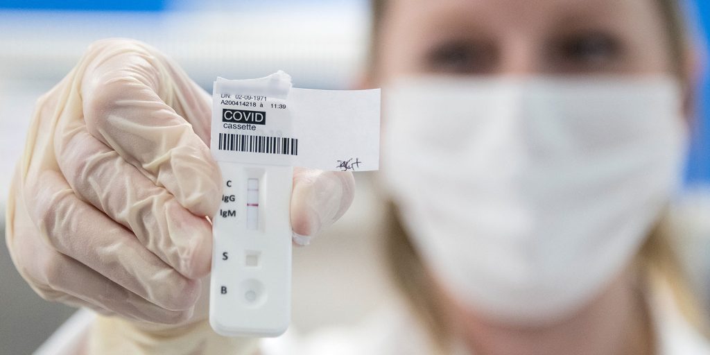 Στο ΦΕΚ δημοσιεύθηκε η υπουργική απόφαση για το πλαφόν στις τιμές των τεστ κορωνοϊού