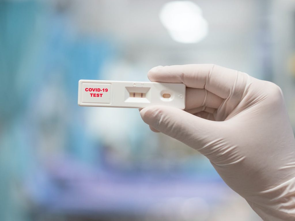 Δείτε που γίνονται σήμερα δωρεάν rapid test από τον ΕΟΔΥ