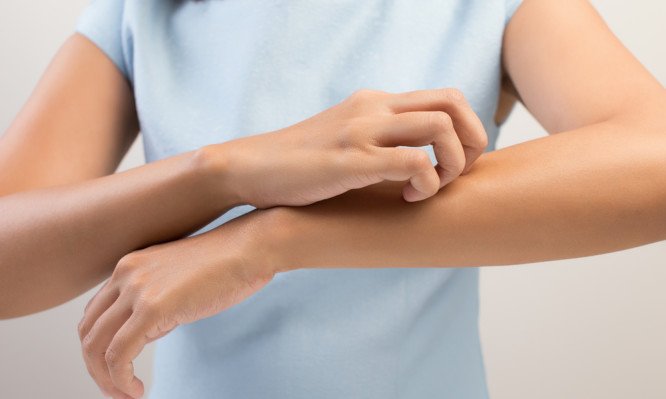 Φαγούρα: Ποιες είναι οι αιτίες και πώς αντιμετωπίζεται;
