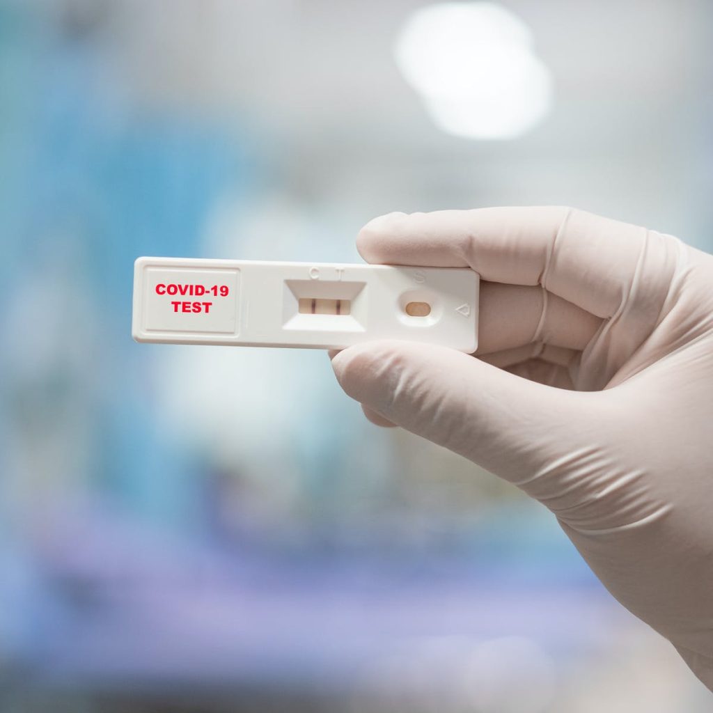 Κορωνοϊός: Σήμερα διενεργήθηκαν 1.245 rapid tests – Πόσα βγήκαν θετικά