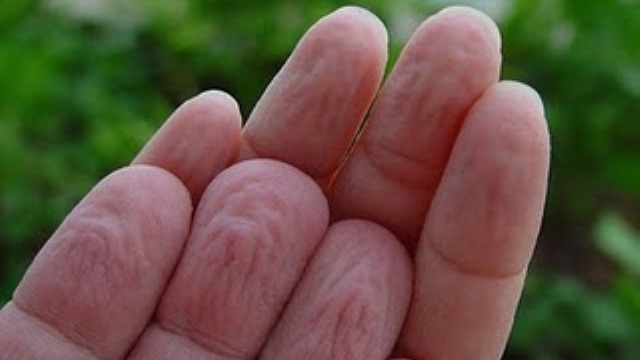 Έχετε αναρωτηθεί; – Πού οφείλονται τα ζαρωμένα δάχτυλα μετά το μπάνιο;